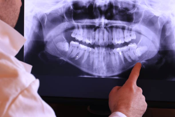 Best Emergency Tooth Extraction  in Matamoras, PA