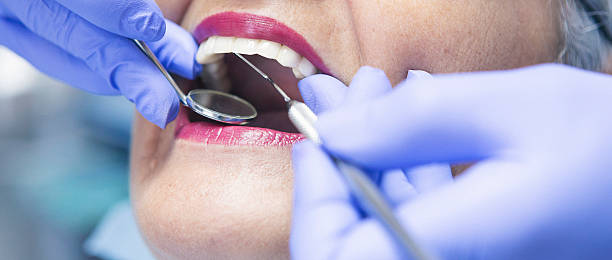 Best Chipped Tooth Repair Near Me  in Matamoras, PA
